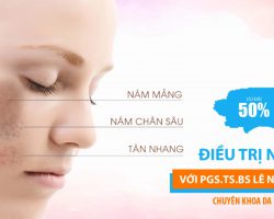 Điều Trị Nám Với PGS.TS.BS Lê Ngọc Diệp CK Da Liễu Ưu đãi 50%